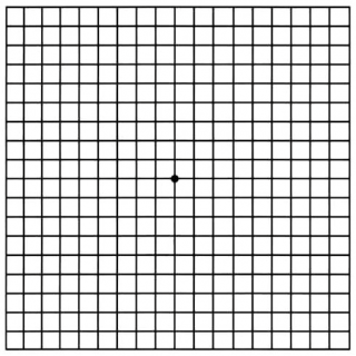 Amsler Grid